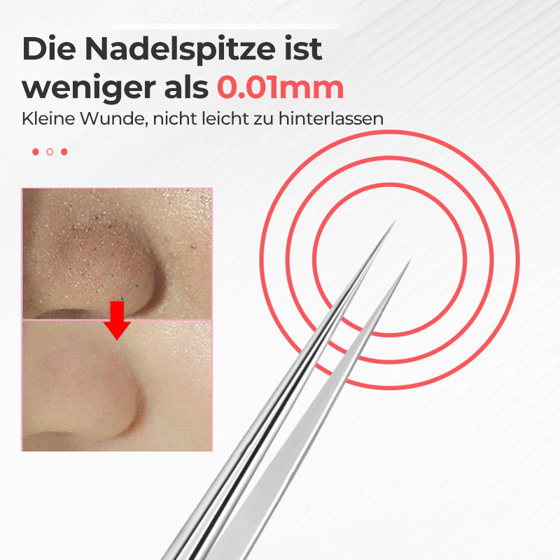 Frendorf | Pinzette zum Entfernen von Mitessern im Gesicht