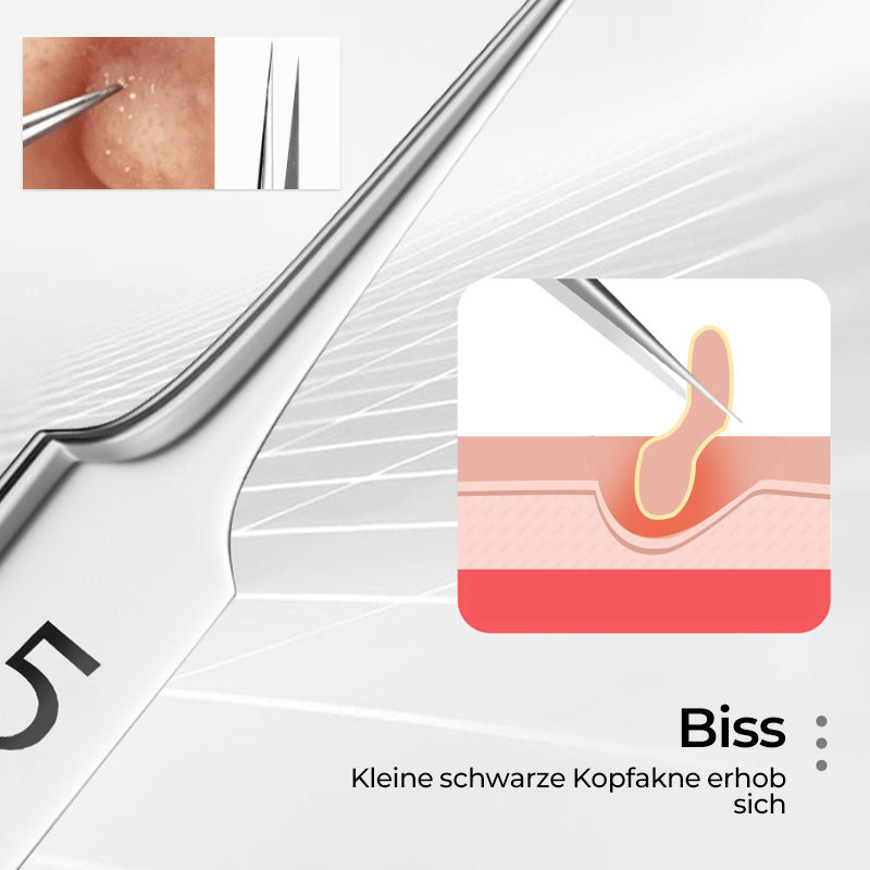 Frendorf | Pinzette zum Entfernen von Mitessern im Gesicht