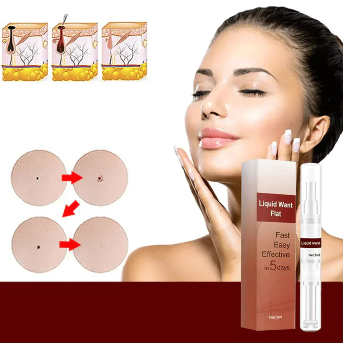 Frendorf | WipeNow - Hartnäckige Flecken und Warzen entfernen