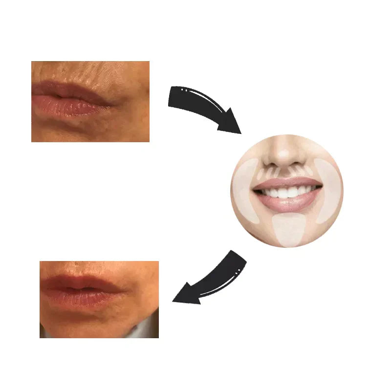 Frendorf | Face Lift Wiederverwendbares Tape