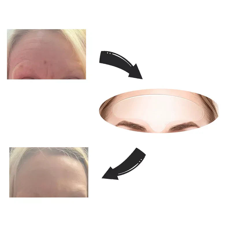 Frendorf | Face Lift Wiederverwendbares Tape