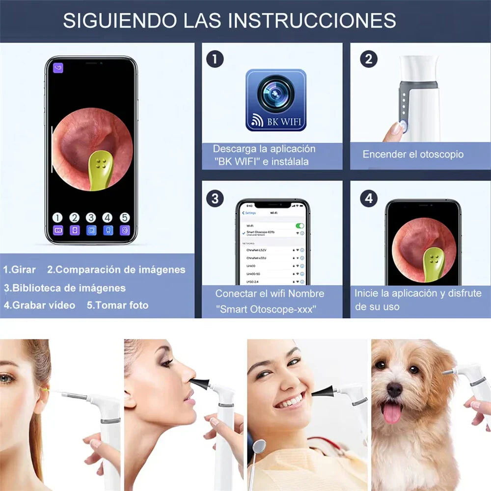 Frendorf | 1080P HD Drahtlose Ohrkamera Otoskop mit 6 LED-Lichtern für Android- und iOS-Geräte