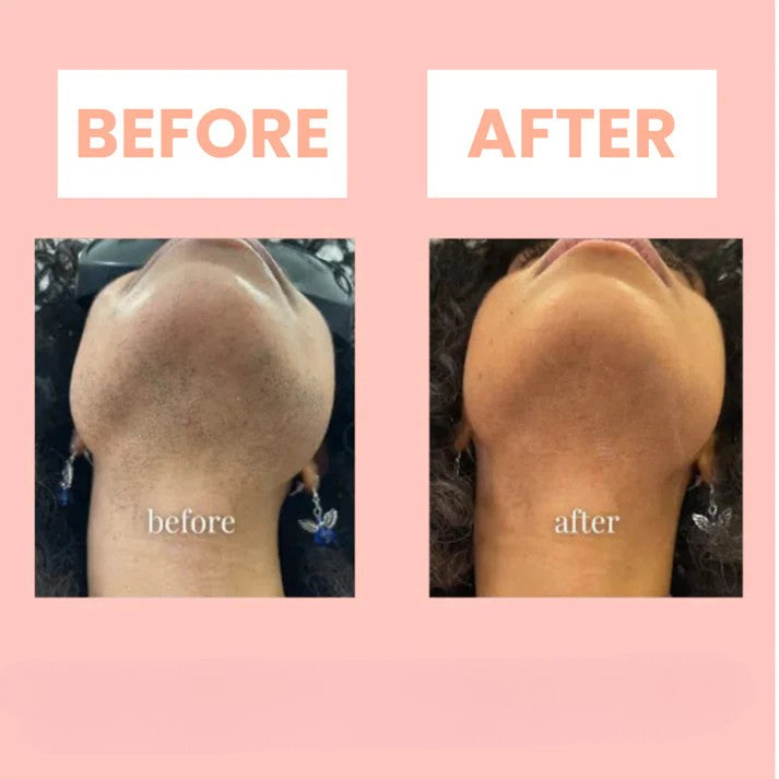 Frendorf | BareSmooth | Enthaarungscreme für Frauen