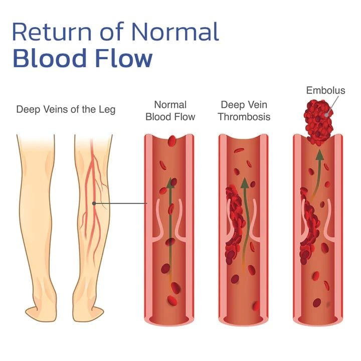 Frendorf |  HeatRelief - Schnelle Schmerzlinderung
