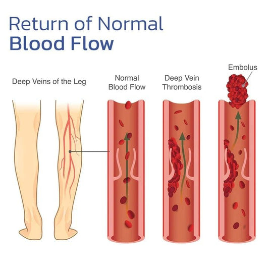 Frendorf |  HeatRelief - Schnelle Schmerzlinderung
