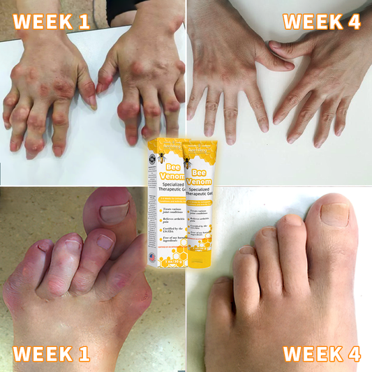 Frendorf | BeeSoothe | Arthritis & Gelenk Gel