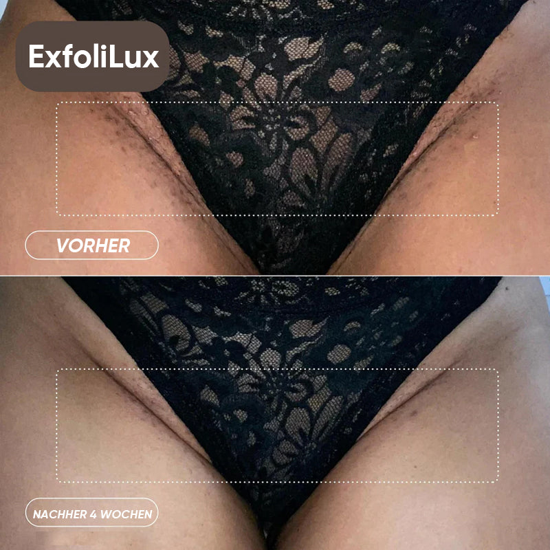 Frendorf |  Manuelles altmodisches Rasiermesser-Set