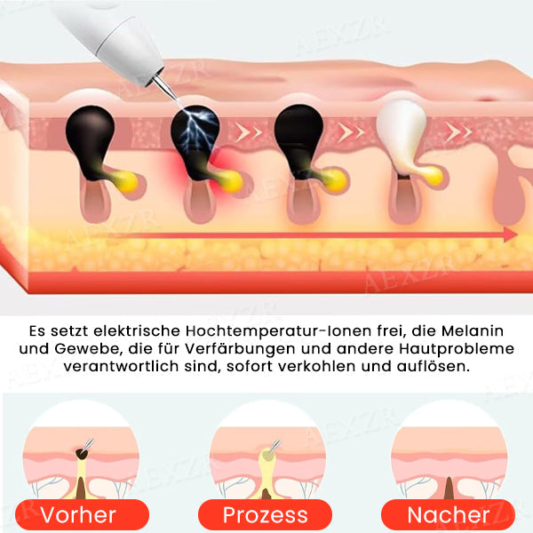Frendorf |  SkinRevive - Verabschieden Sie sich von Hautunreinheiten