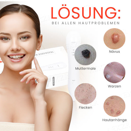 Frendorf |  SkinRevive - Verabschieden Sie sich von Hautunreinheiten