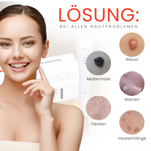 Frendorf |  LuminSkin - Verabschieden Sie sich von Hautunreinheiten