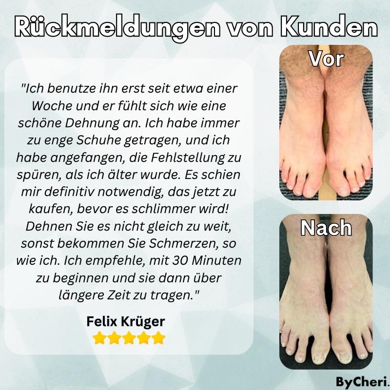 Frendorf | 1+1 GRATIS TEMPORÄR | OrthoAlign – Großzehenkorrektor