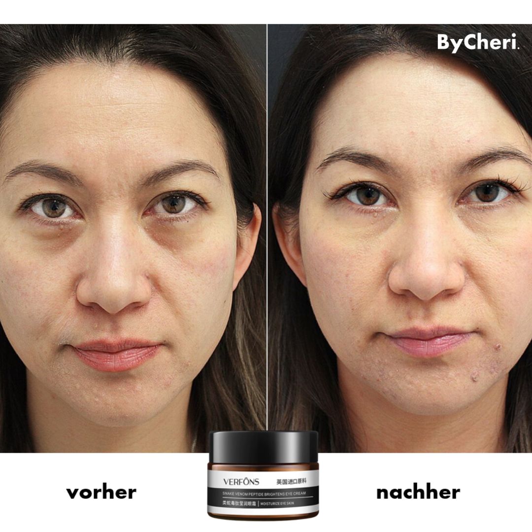 Frendorf | 1+1 GRATIS TEMPORÄR | EyeRejuv- Faltenentfernende Augencreme!