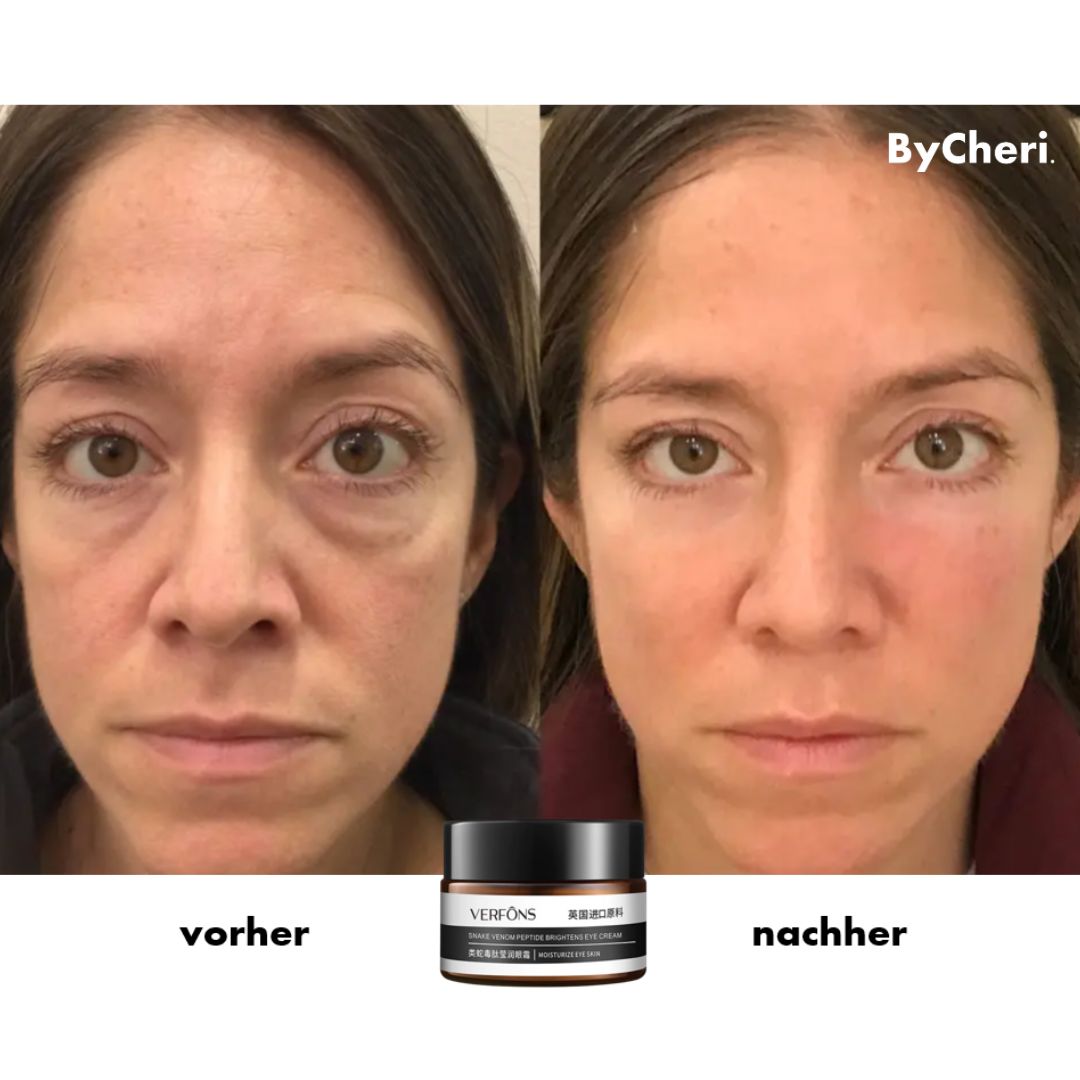 Frendorf | 1+1 GRATIS TEMPORÄR | EyeRejuv- Faltenentfernende Augencreme!