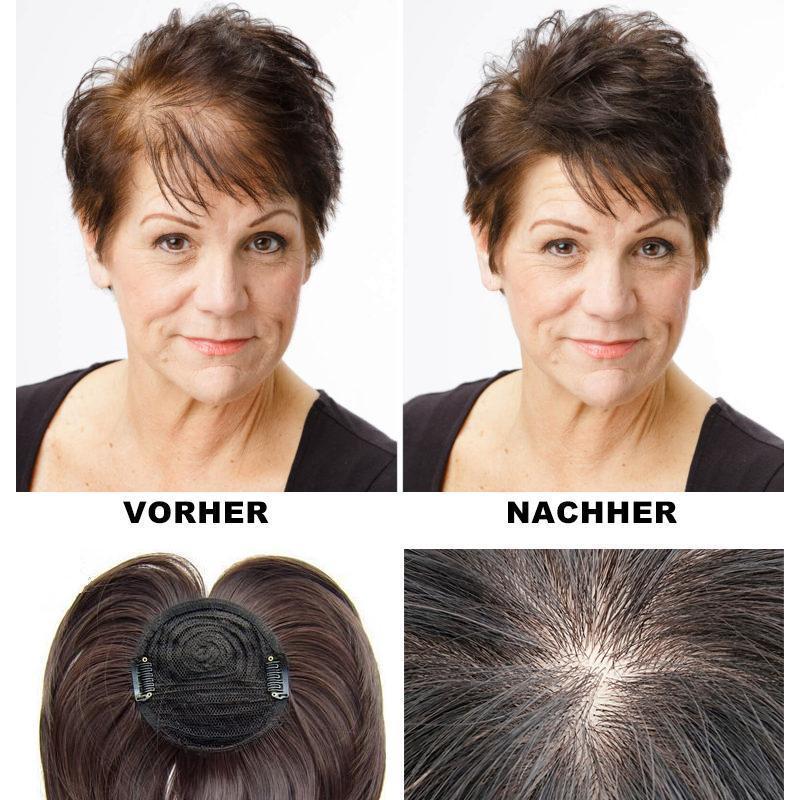 Frendorf | Spezielles Kopf-Haarstück