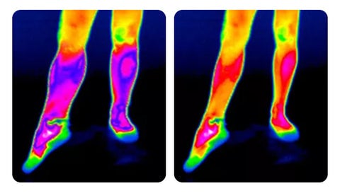 Frendorf |  HeatRelief - Schnelle Schmerzlinderung