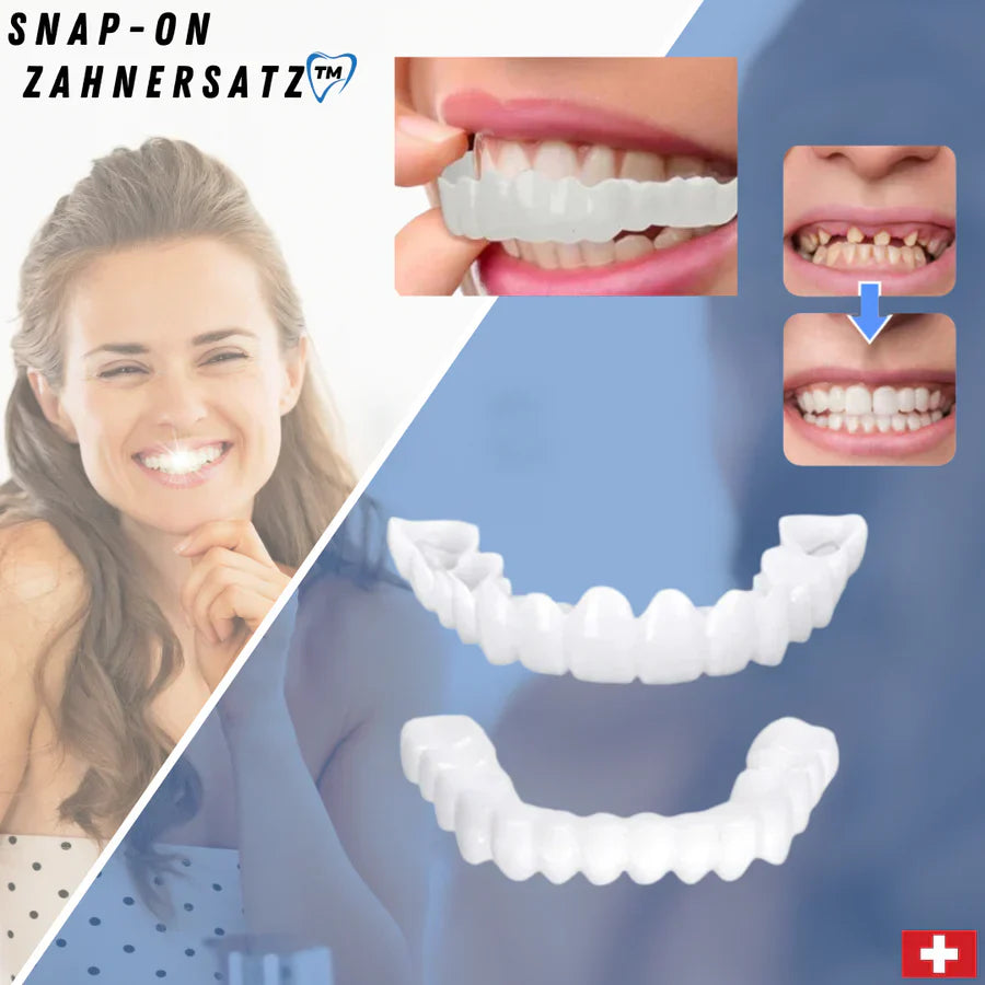 Frendorf | SnapFit Zahnrestauration | Stets ein Makelloses Lächeln