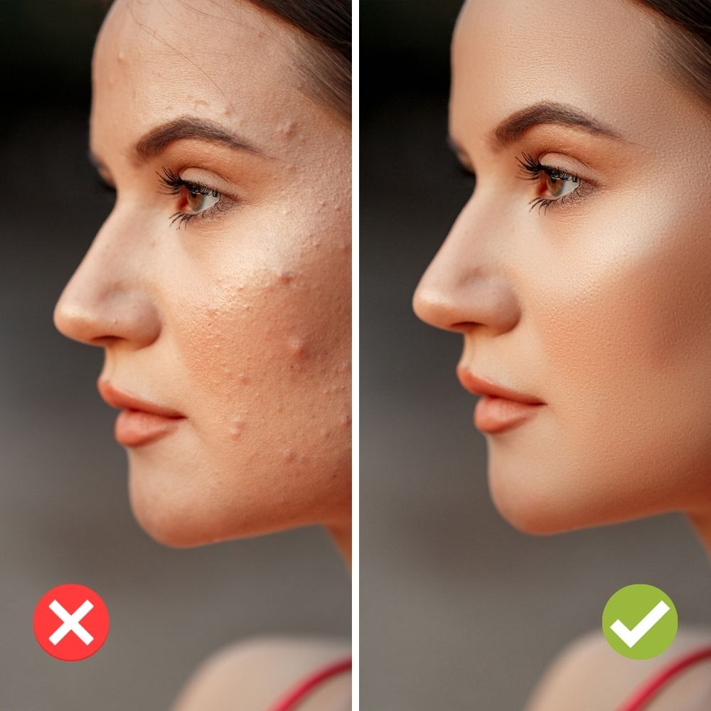 Frendorf | Betone deinen natürlichen Hautton mit dem perfekten Ölkontrollpuder