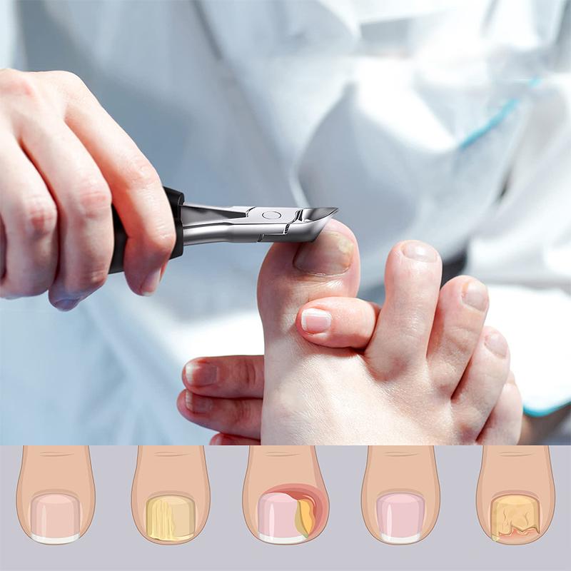 Frendorf | 304 Edelstahl Nagelknipser Set