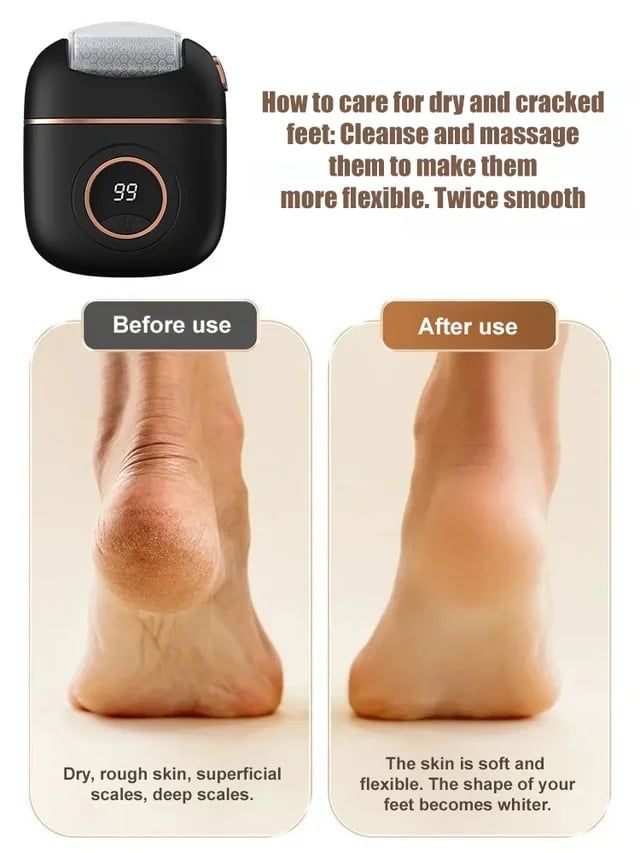 Frendorf | 2025 Neue digitale elektrische Fußpoliermaschine