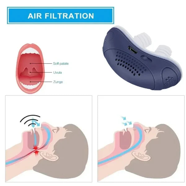 Frendorf | Schlaflos, maskenlos, Micro-CPAP Anti-Schnarch