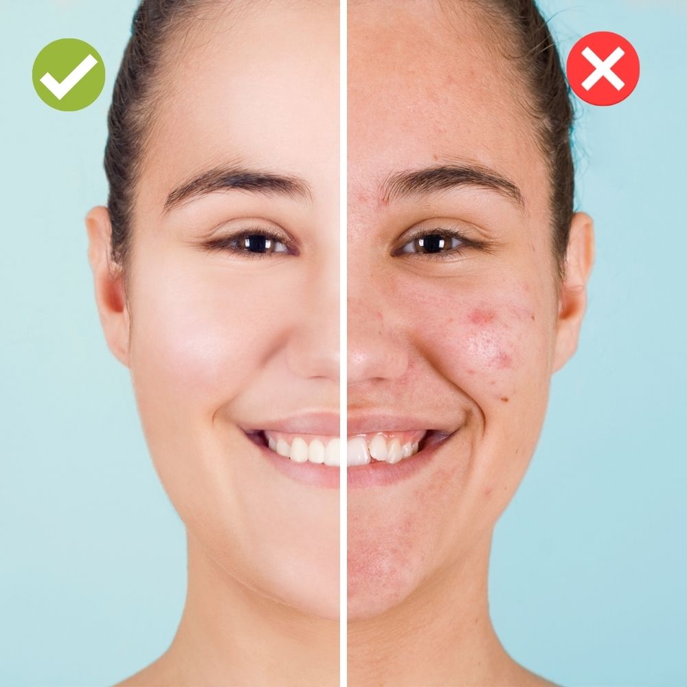 Frendorf | Betone deinen natürlichen Hautton mit dem perfekten Ölkontrollpuder