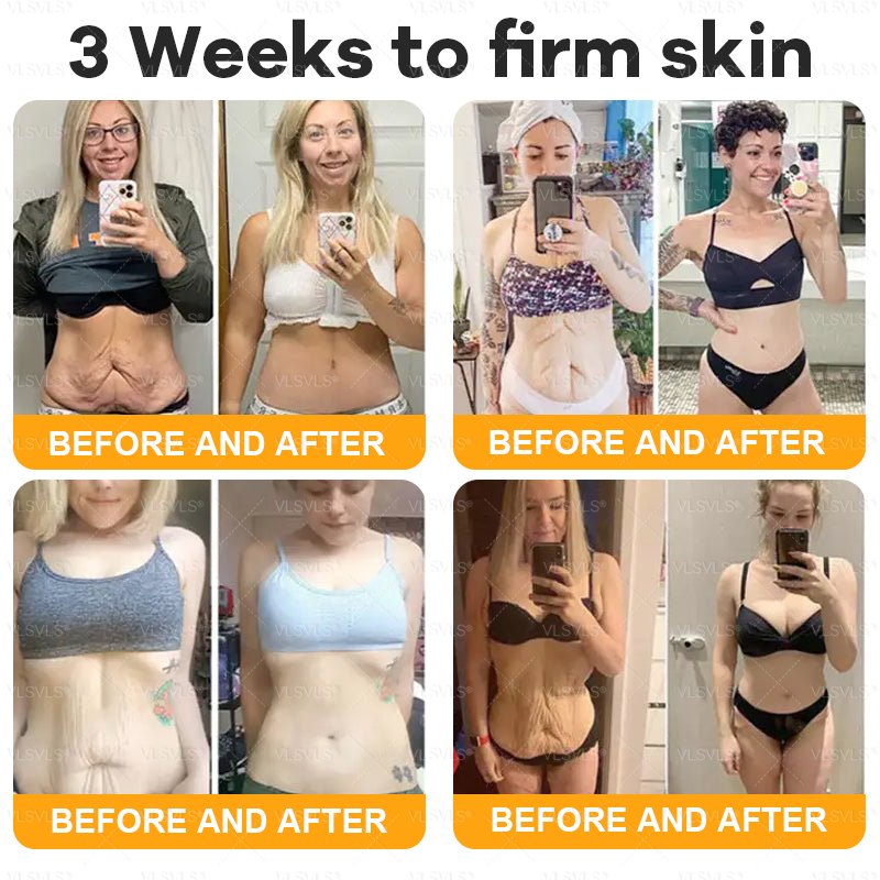 Frendorf | BeeTag– Straffende Anti-Aging-Creme mit Bienengift-Peptiden