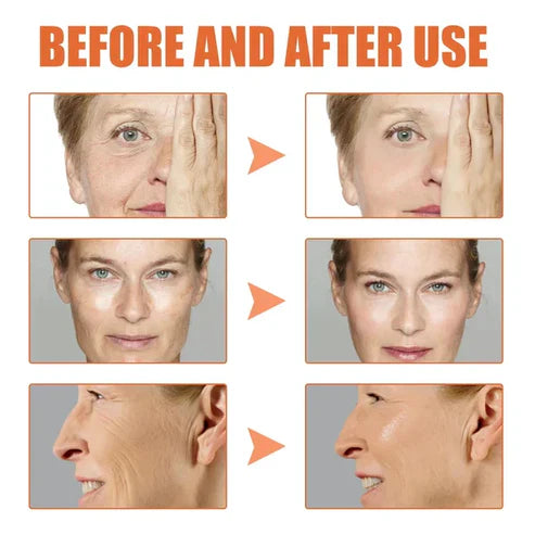 Frendorf | YouthRevive – Botox Anti-Aging Serum für Strahlende Haut