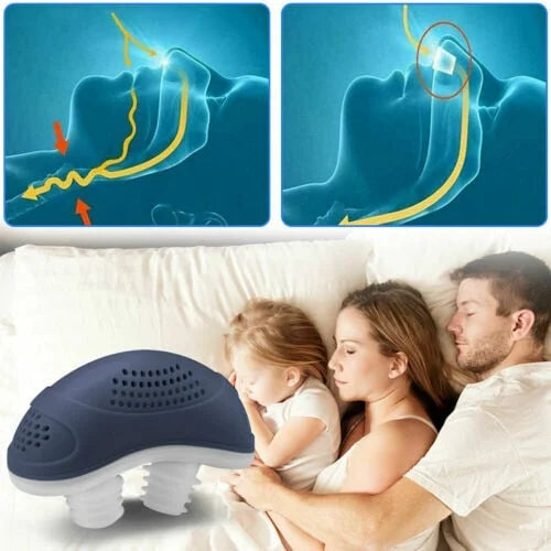 Frendorf | Schlaflos, maskenlos, Micro-CPAP Anti-Schnarch
