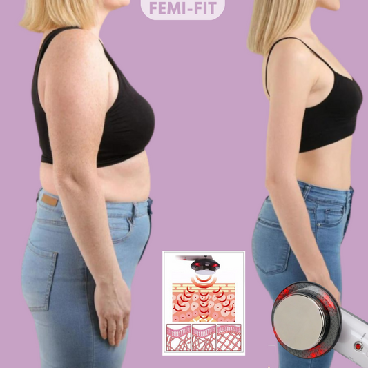 Frendorf | 3-in-1 Tier- und Cellulite-Entferner - SlimShape