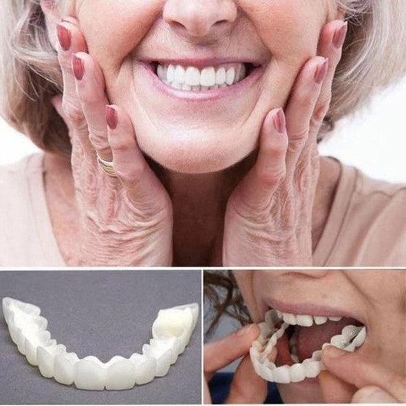 Frendorf | On Smile Veneers (Ober- und Unterkiefer inbegriffen)