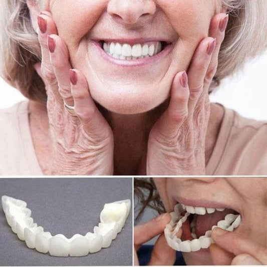 Frendorf | On Smile Veneers (Ober- und Unterkiefer inbegriffen)