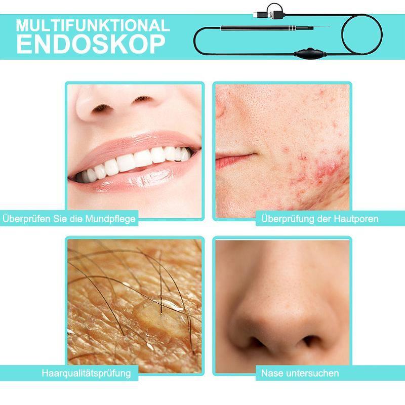 Frendorf | 3 in 1 Ohrreinigung Endoskop mit 6 Einstellbare LED-Licht
