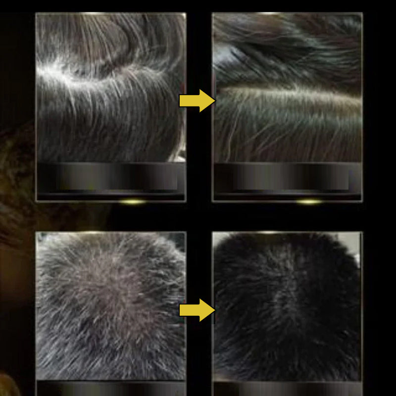 Frendorf | 3 in 1 Schwarze Haar Shampoo Spülung