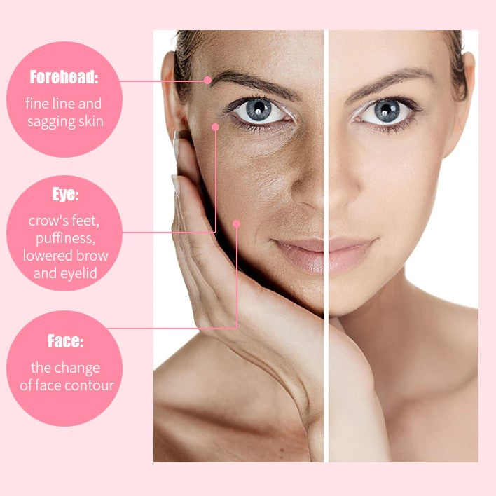 Frendorf | 1+1 NUR HEUTE KOSTENLOS | SkinGel- Anti Pores für glattere und straffere Haut!