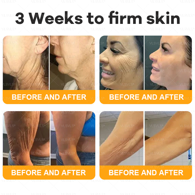 Frendorf | BeeTag– Straffende Anti-Aging-Creme mit Bienengift-Peptiden