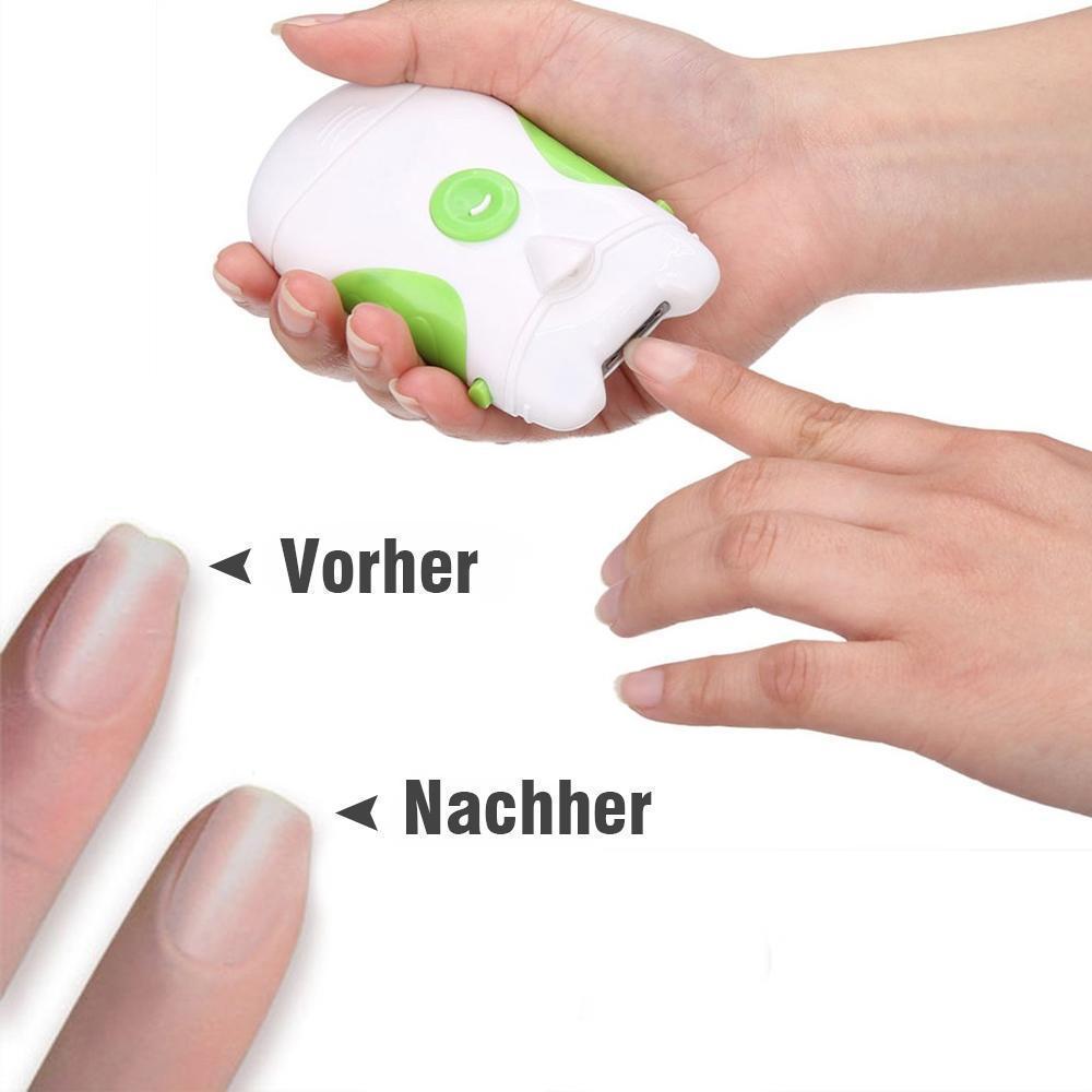 Frendorf | Bequee Elektrischer Nagelschneider mit LED-Licht