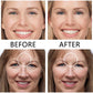 Frendorf | Face Nutrition Faltenentfernung Lift Aufkleber