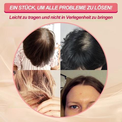 Frendorf | Spezielles Kopf-Haarstück