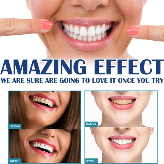 Frendorf | BlitzWhite | Zahnaufhellung Pen