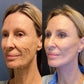 Frendorf | YouthRevive – Botox Anti-Aging Serum für Strahlende Haut