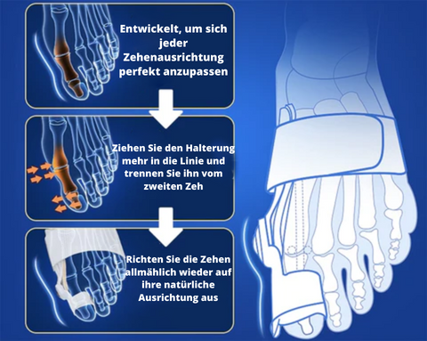 Frendorf | Ballenzehkorrektor - Rette deinen Zeh bevor es zu spät ist!