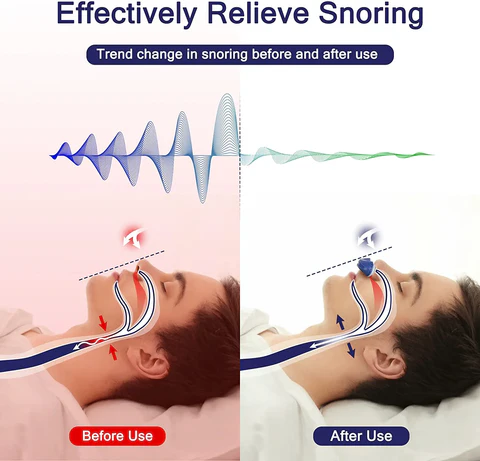 Frendorf | Micro CPAP Schlafapnoe-Maschine für Reisen & Anti-Schnarchen - CPAP-Alternative