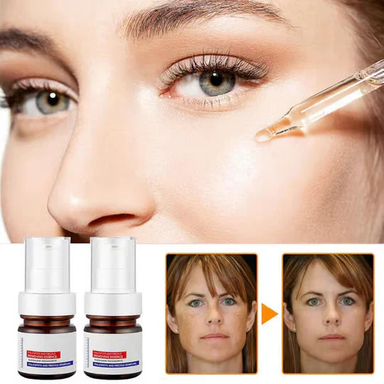 Frendorf | SpotLuxe – Serum zur Entfernung von Dunklen Flecken