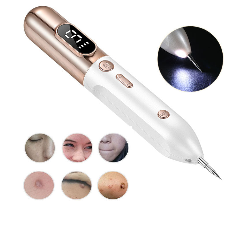 Frendorf | Plasma-Pen-Laser zur Tattoo- und Muttermalentfernung