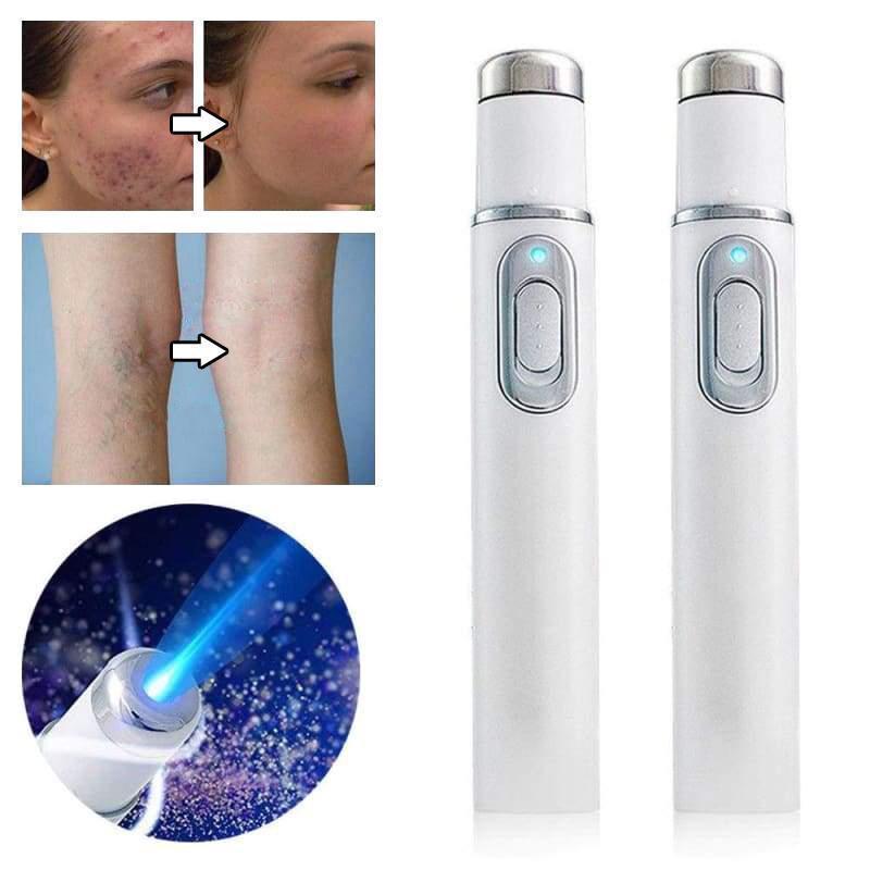 Frendorf | Laserbehandlung-Stift  Blu-Ray unerwünschte Akne entfernen
