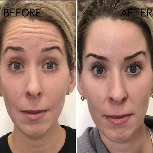 Frendorf | YouthRevive – Botox Anti-Aging Serum für Strahlende Haut