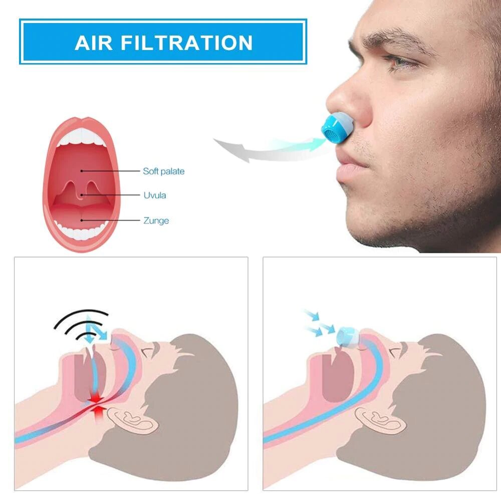 Frendorf | Anti-Schnarch-Gerät | Schlauchloses, maskenloses Mikro-CPAP