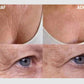 Frendorf | Anti-Falten Silikon-Pads