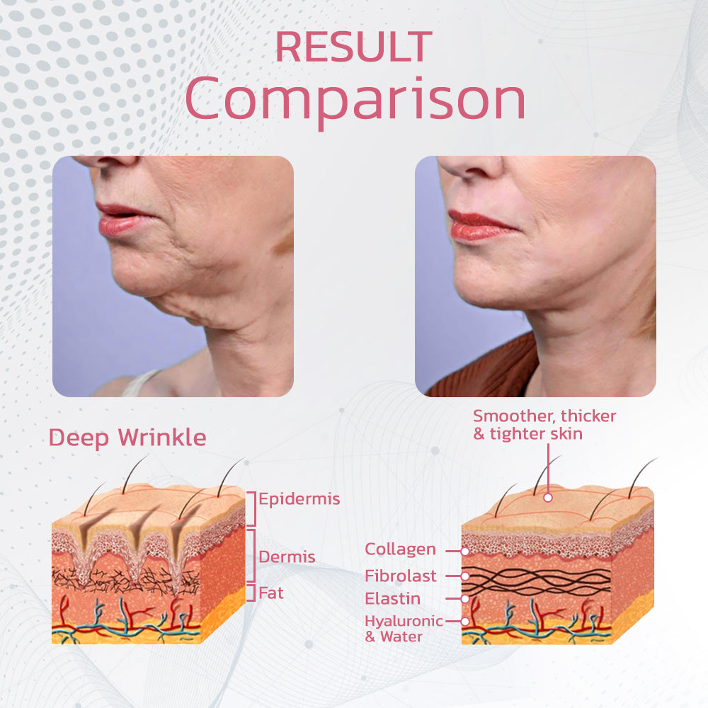 Frendorf | Beautify - Säubern Sie Ihr Lymphsystem!