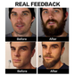 Frendorf | BeardSerum - Präzisions-Bart-Booster